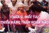 Chữa Ù Tai, Điếc Tai & Rối Loạn Tuần Hoàn Não Bằng Bấm Huyệt Thập Chỉ Liên Tâm (bài 35)
