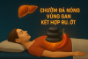 Chườm Đá Nóng Vùng Gan & Ru. Ớt – Phương Pháp Đơn Giản, Rẻ Tiền, Hiệu Quả Cao