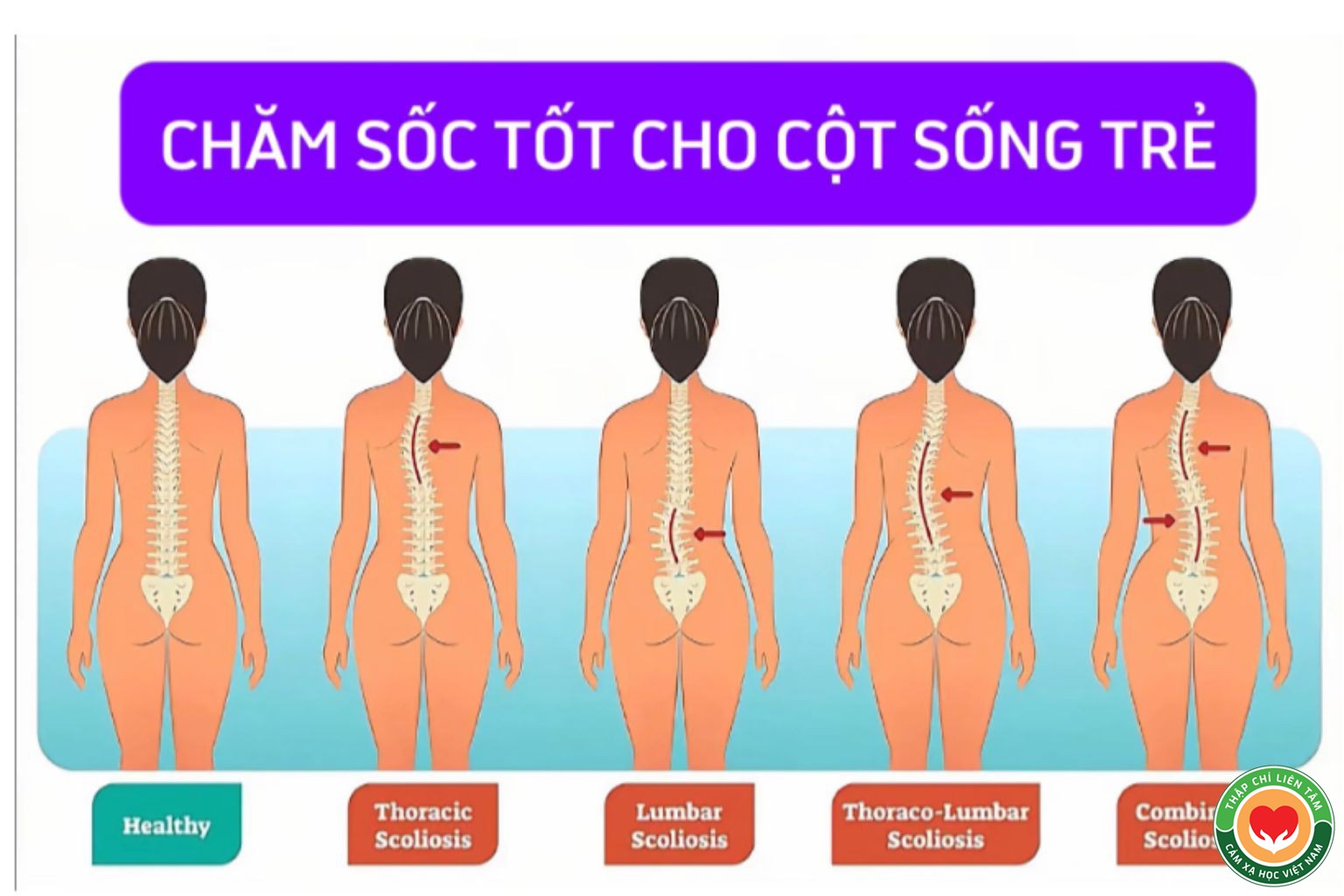 Chăm Sóc Trẻ Sơ Sinh: Hướng Dẫn Bảo Vệ Cột Sống Cho Bé (bài 9)