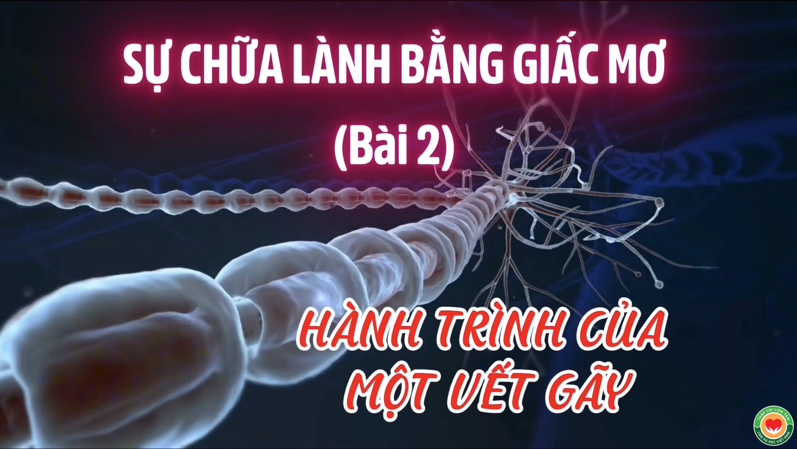 Đôi Khi, Sự Vỡ Vụn Của Xương Là Khởi Đầu Cho Sự Liền Lại Của Linh Hồn (Bài 02)