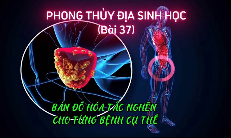 Bản Đồ Hóa Tắc Nghẽn Cho Từng Bệnh Cụ Thể (Bài 37)